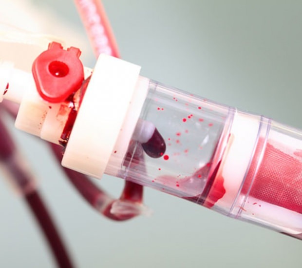 Was ist ein niedriges Blutplättchen (PLT)? Was sind die Symptome eines Thrombozytenmangels?