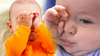 Natürliche Lösungen gegen Augenverbrennung bei Babys