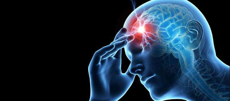 Arten von Kopfschmerzen