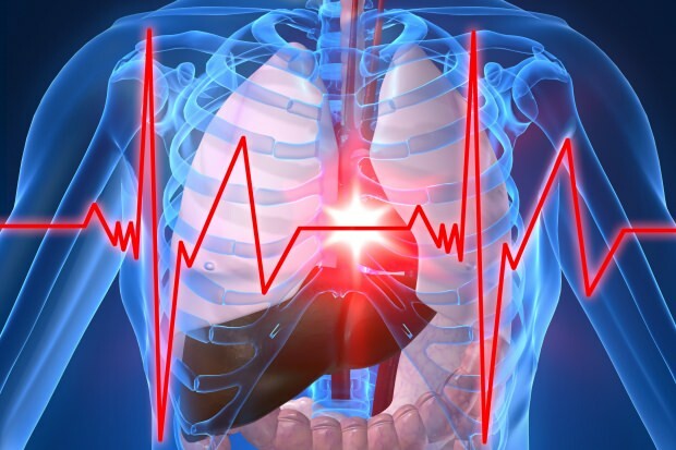 Was sind die Symptome eines Herzinfarkts?