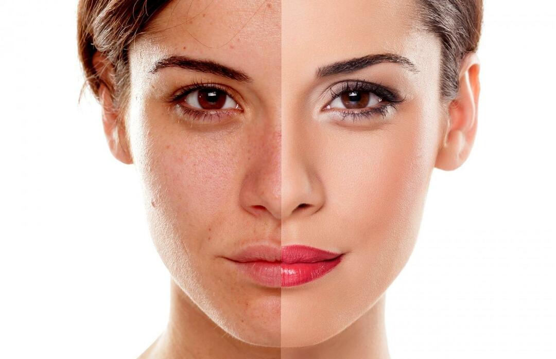 Wie verhindern wir, dass die Haut müde aussieht? Wie kann man das müde Aussehen der Haut reduzieren?