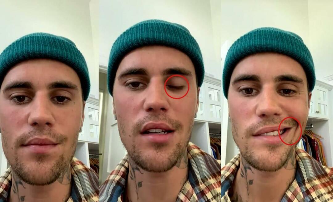 Justin Bieber hatte eine Gesichtslähmung! Der berühmte Star kann nicht noch einmal auf Welttournee gehen