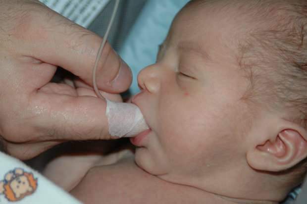 Was ist die Fingerfütterungsmethode? Wie füttere ich das Baby mit einer Spritze?