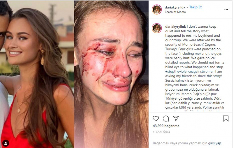 Das ukrainische Topmodel Daria Kyryliuk, angeblich in İzmir Çeşme geschlagen, sprach zum ersten Mal!