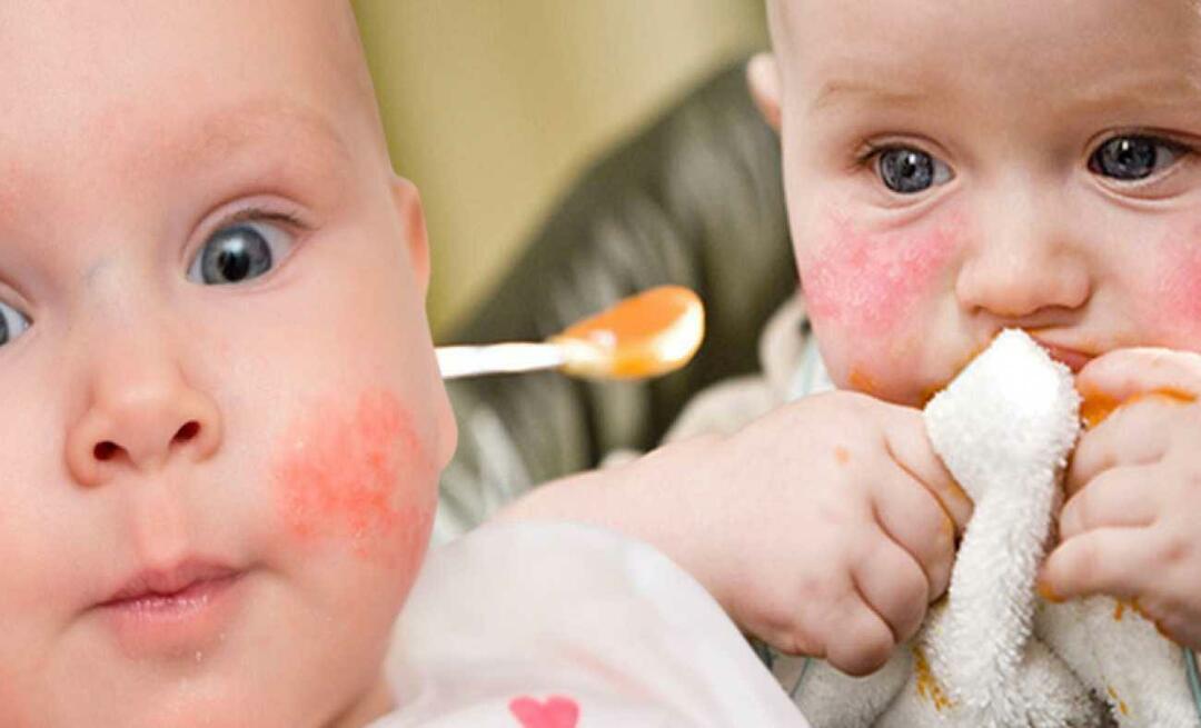 Was sollte ein Baby mit Allergien essen? Was sind alternative Nahrungsmittel für allergische Babys?