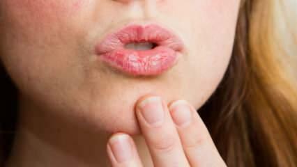 Wie macht man Lippenpflege zu Hause? Einfache trockene Lippenpflege in 4 Schritten