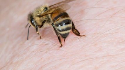 Was ist eine Bienenallergie und was sind die Symptome? Natürliche Methoden, die gut für Bienenstiche sind