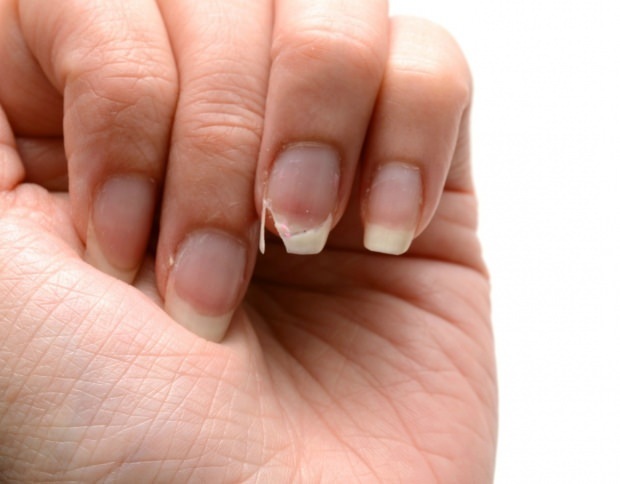 Wie erfolgt die Nagelpflege? Schnelle Nagelverlängerungsmethoden