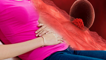 Was ist Implantationsblutung während der Schwangerschaft? Wie man Platzierungsblutungen von Menstruationsblutungen unterscheidet