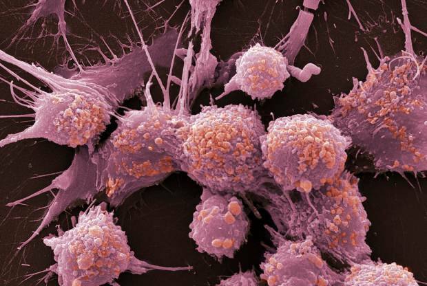Was ist Krebs? Was sind die Symptome von Krebs? Wie viele Krebsarten gibt es? Wie kann Krebs verhindert werden?