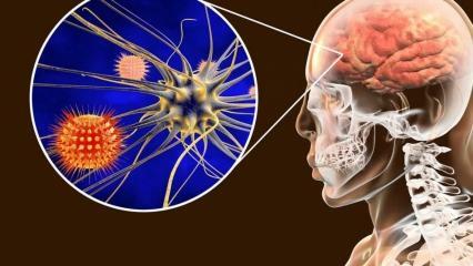 Was ist Meningitis und was sind ihre Symptome? Gibt es eine Behandlung für Meningitis?